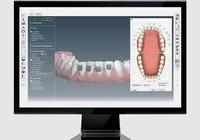 Screenshot of OrthoSelect application allows orthodontists and dentists to offer 3D models of their patients' teeth. The software and models are used in treatment planning and in specialized cases, such as OrthoSelect’s digital indirect bonding service (DIBS).

Type: Desktop

Technology: 3D, C++, OpenGL, VTK, IEC 62304, ThreeJS.
