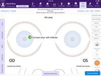 Screenshot of EMA for ophthalmology  - Slit Lamp Cornea Cataract Refractive
