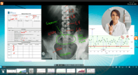 Screenshot of Medical Presentation - doctors can engage patients and present complex and visual information