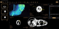 Screenshot of Medical Imaging PACS, VNA, and ZFP viewer
