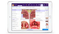 Screenshot of EMA EHR system for Otolaryngology